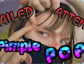 4k undefined FAILED ATTEMPT Pimple Pop! (teaser)